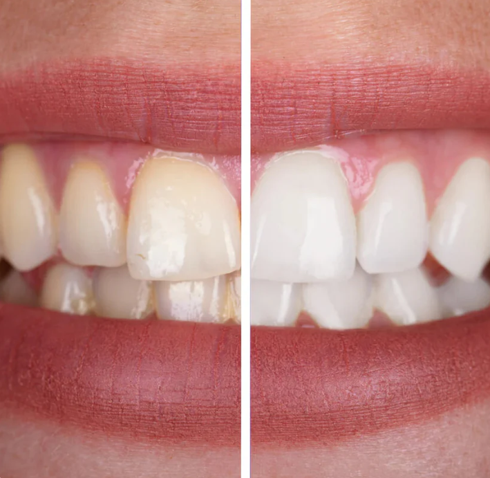 Dentifrice Violet Blanchissant